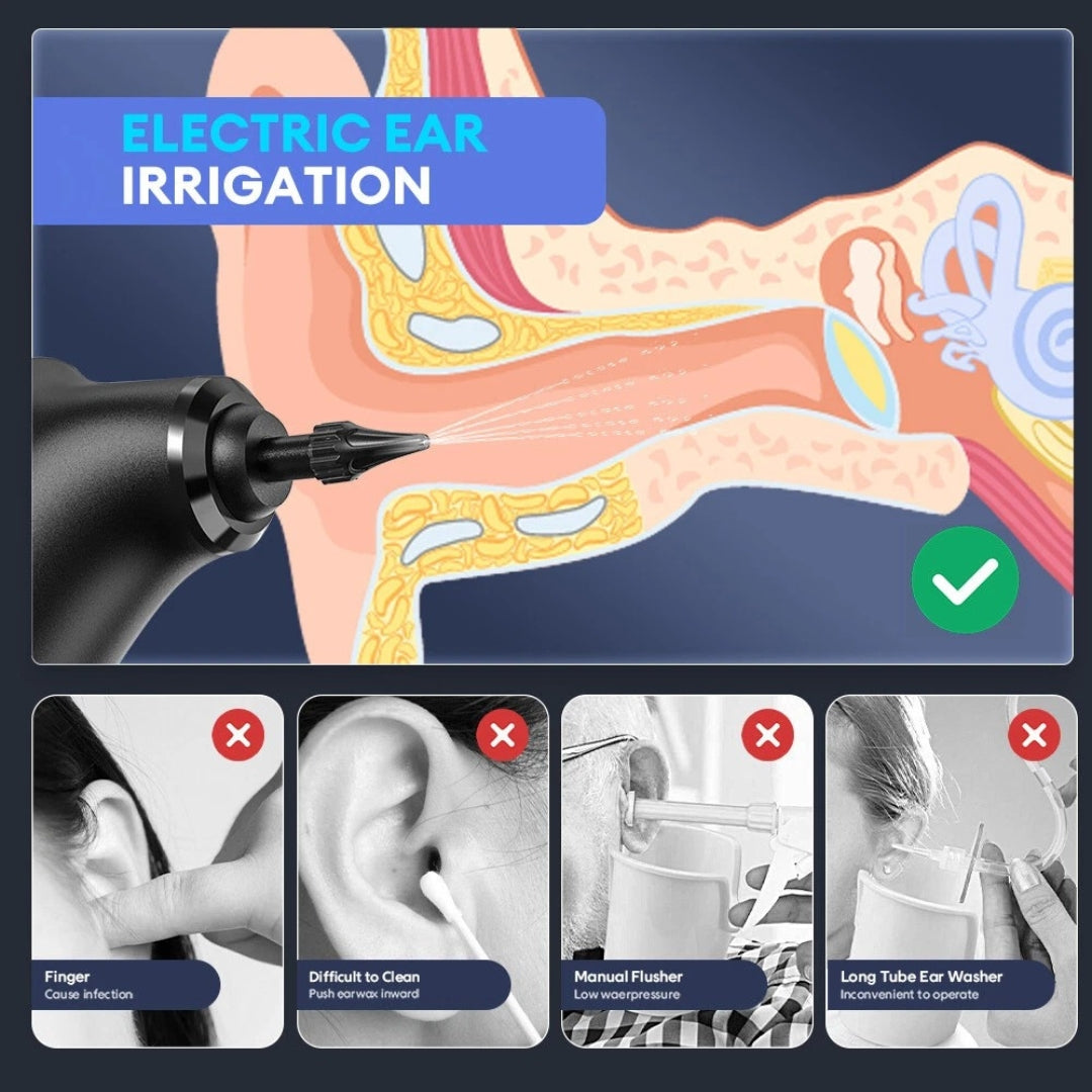 HydroLobe™ - Ear Wax Remover