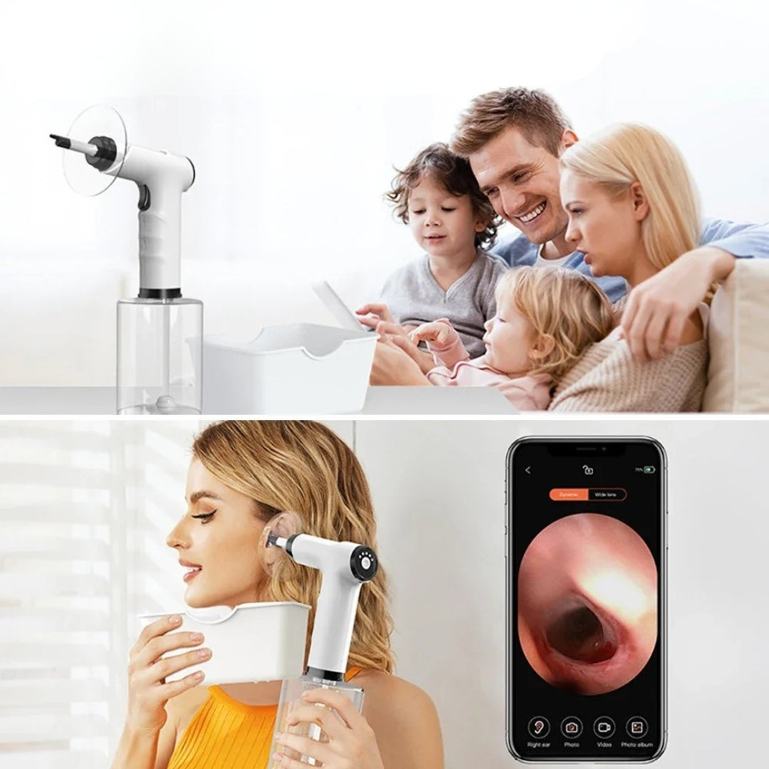 EariFlow™ - Ear Wax Remover