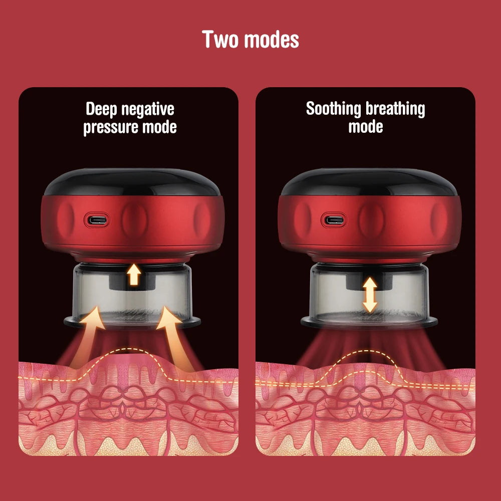 CupTherm™ - Thermal Cupping, Reinvented.
